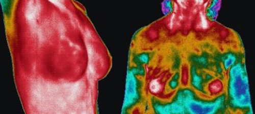 Thermography